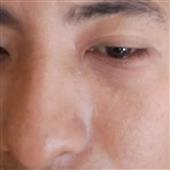 te
