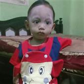 Th